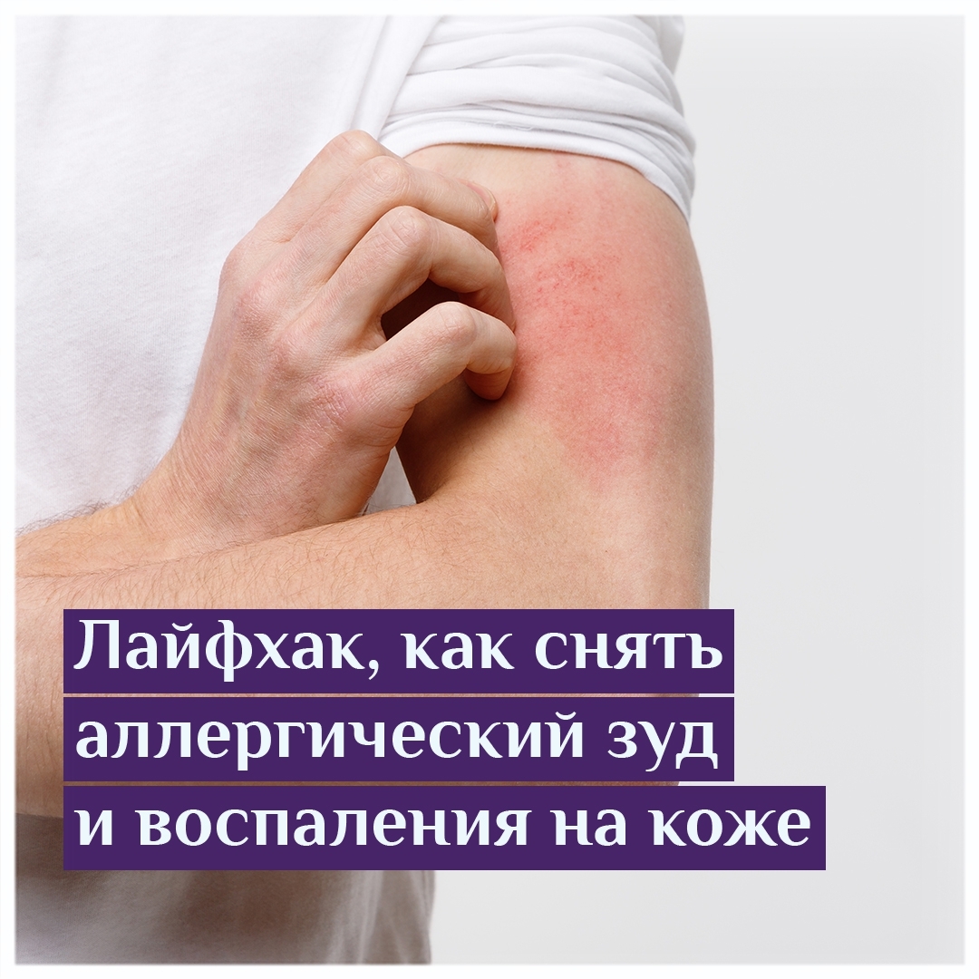 Какие есть средства против аллергии? Лайфхаки, как можно снять  аллергический зуд или воспаления на коже | Официальный сайт препарата  Парлазин Нео в Беларуси